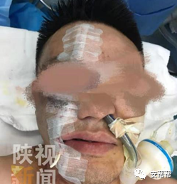 电动角磨机工作原理_电动角磨机用途_电动角磨机的使用方法及注意事项