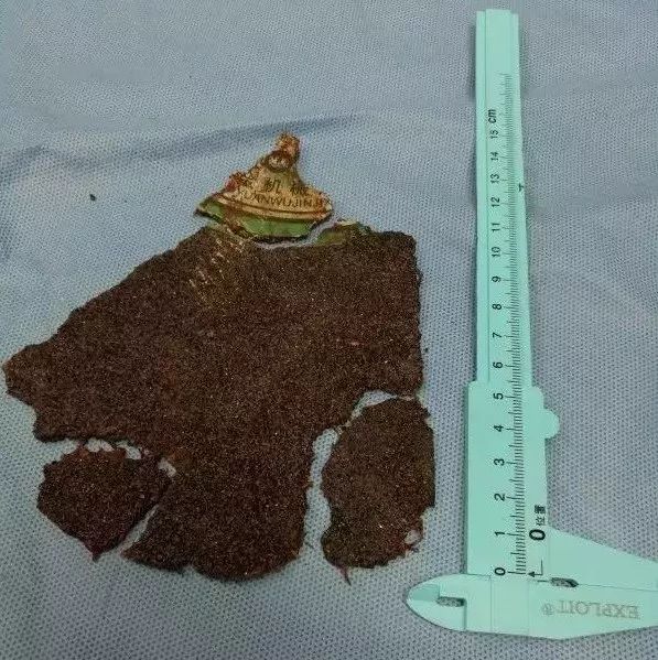 电动角磨机的使用方法及注意事项_电动角磨机使用注意事项哪些_电动角磨机工作原理