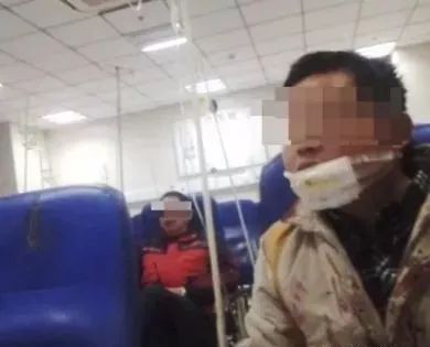 电动角磨机使用注意事项哪些_电动角磨机工作原理_电动角磨机的使用方法及注意事项