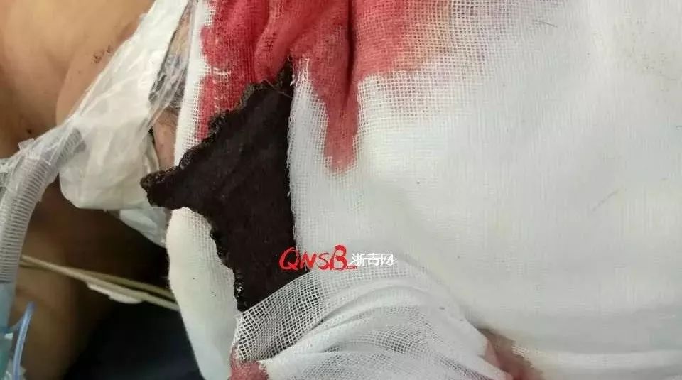 电动角磨机的使用方法及注意事项_电动角磨机使用注意事项哪些_电动角磨机工作原理