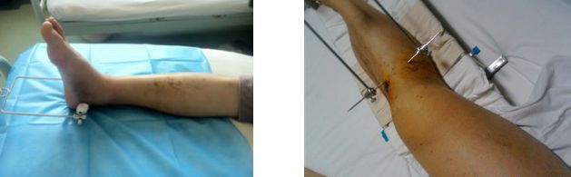 电锤操作方法_电锤使用方法_电锤的使用方法的视频教程