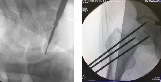 电锤的使用方法的视频教程_电锤使用方法_电锤操作方法