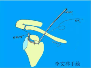 电锤操作方法_电锤的使用方法的视频教程_电锤使用方法
