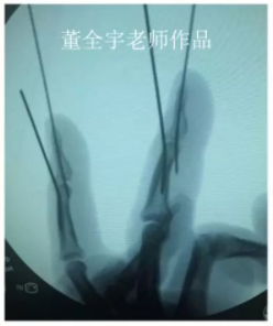 电锤的使用方法的视频教程_电锤操作方法_电锤使用方法