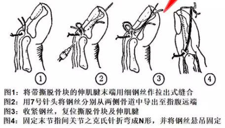 电锤的使用方法的视频教程_电锤使用方法_电锤操作方法