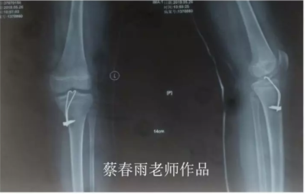 电锤使用方法_电锤的使用方法的视频教程_电锤操作方法