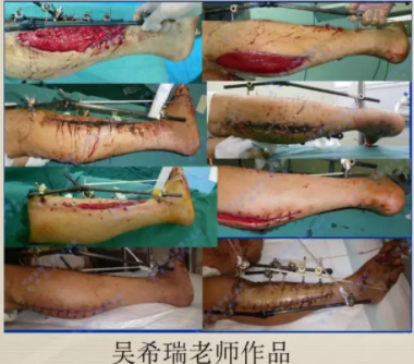 电锤的使用方法的视频教程_电锤使用方法_电锤操作方法