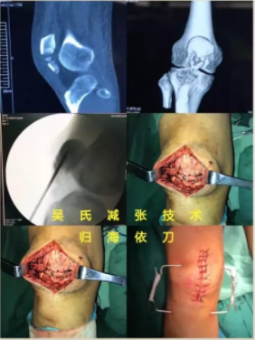 电锤使用方法_电锤操作方法_电锤的使用方法的视频教程